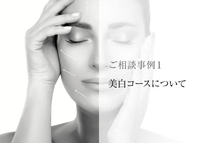 ご相談事例１／美白コースについて